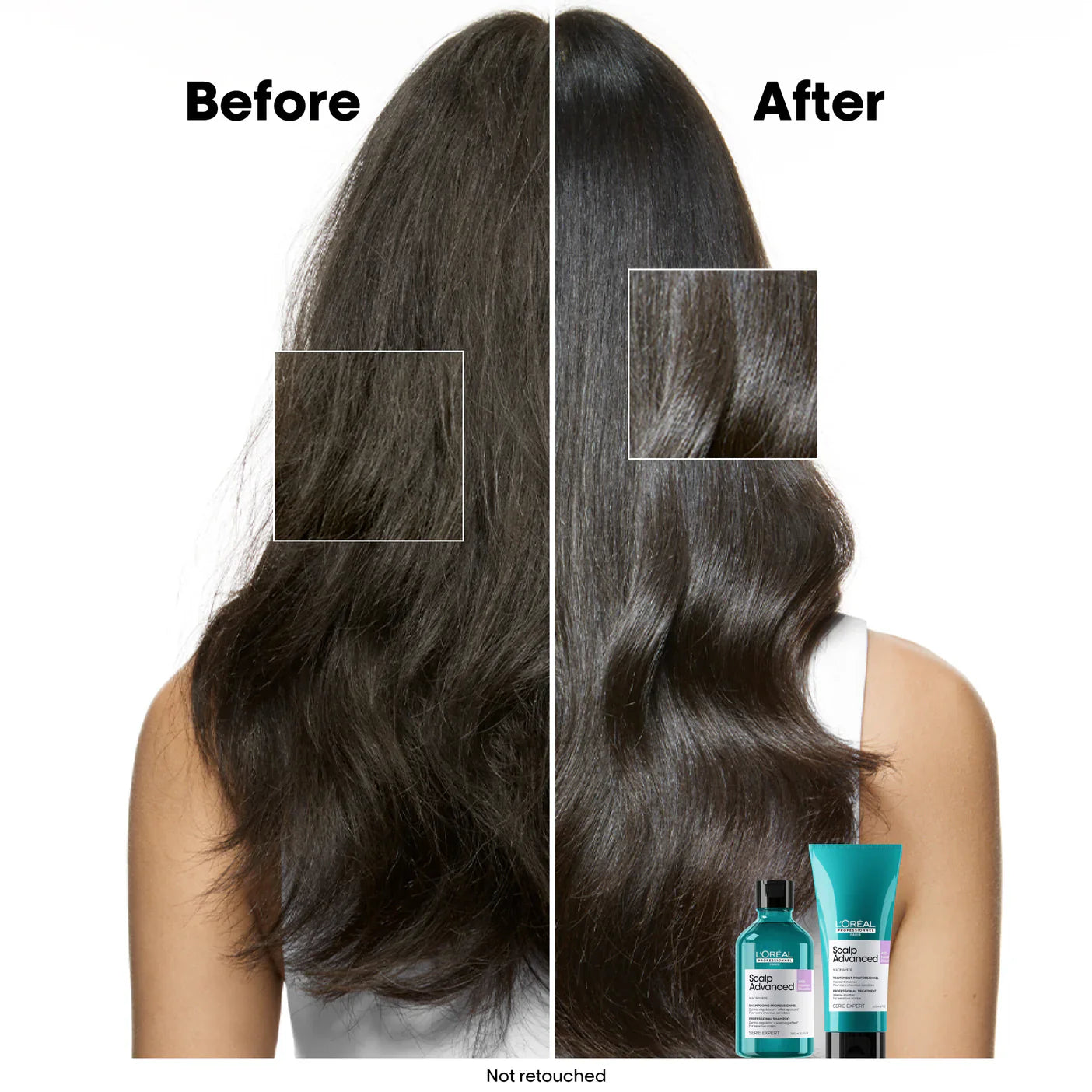 L'Oreal Professionnel Serie Expert Scalp Advanced Anti-Discomfort Dermo-Regulator Shampoo 300ml