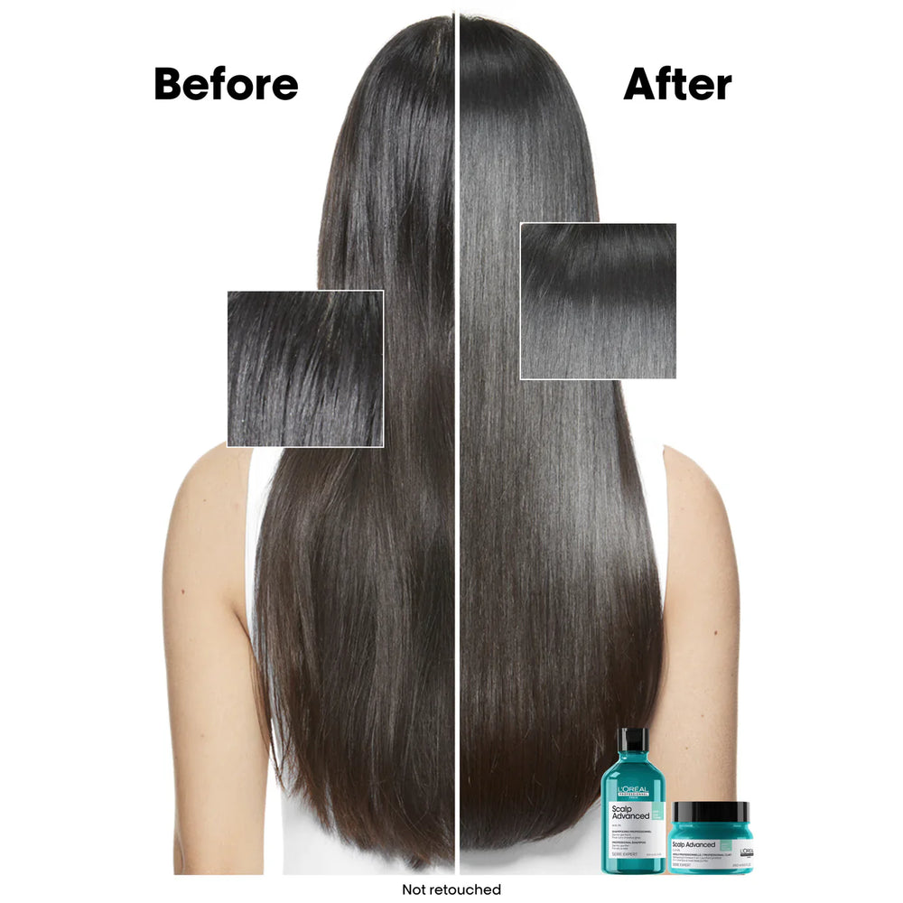 L'Oreal Professionnel Serie Expert Scalp Advanced Anti-Oiliness Dermo-Purifier Shampoo 500ml