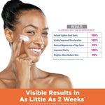 Palmer's Skin Success Fade Cream for Oily Skin 75g