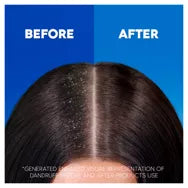 Head & Shoulders Classic Clean Clarifying Anti Dandruff Shampoo For Itchy, Dry Scalp And Hair 400ml