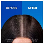 Head & Shoulders Classic Clean Clarifying Anti Dandruff Shampoo For Itchy, Dry Scalp And Hair 400ml