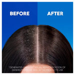 Head & Shoulders Apple Fresh 2in1 Anti-Dandruff Shampoo and Conditioner For Dry Hair And Scalp 400ml