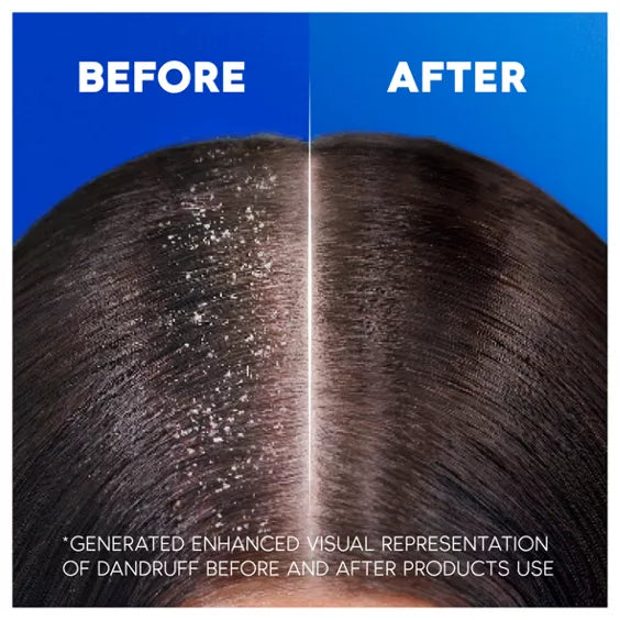 Head & Shoulders Smooth & Silky Anti-Dandruff Shampoo for Frizzy Hair 400ml