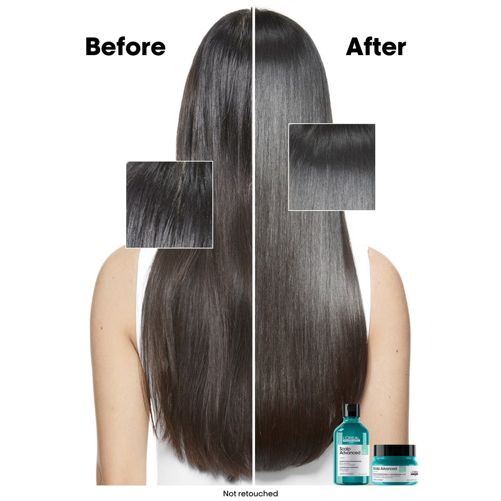 L'Oréal Professionnel Scalp Advanced Anti-Oiliness 2-In-1 Shampoo & Mask 250ml