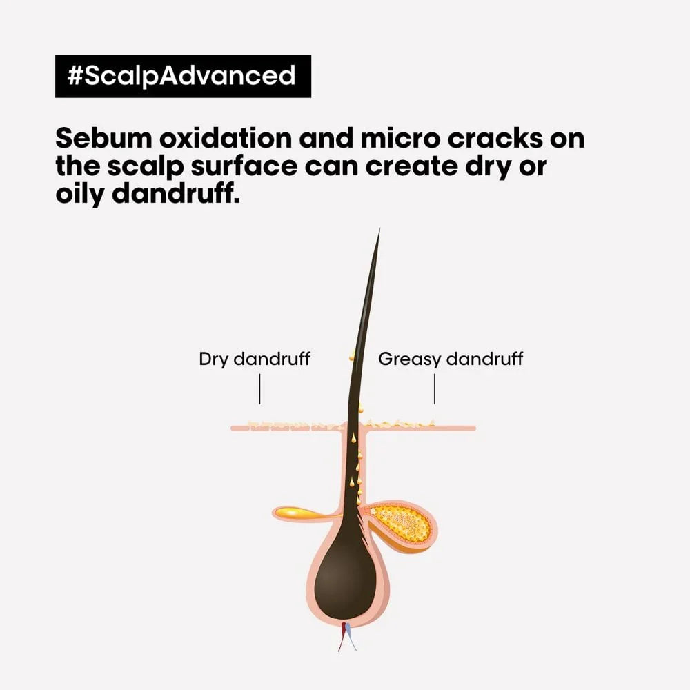 L'Oreal Professionnel Serie Expert Scalp Advanced Anti-Dandruff Dermo-Clarifier Shampoo 300ml