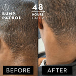 Bump Patrol Original Aftershave 57g
